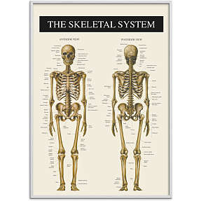 Skelettet 2 - 70x100 cm