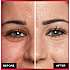 Concealer 325 Bisque